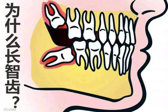 人为什么会长智齿？拔牙要多少钱？智齿一定要拔吗？