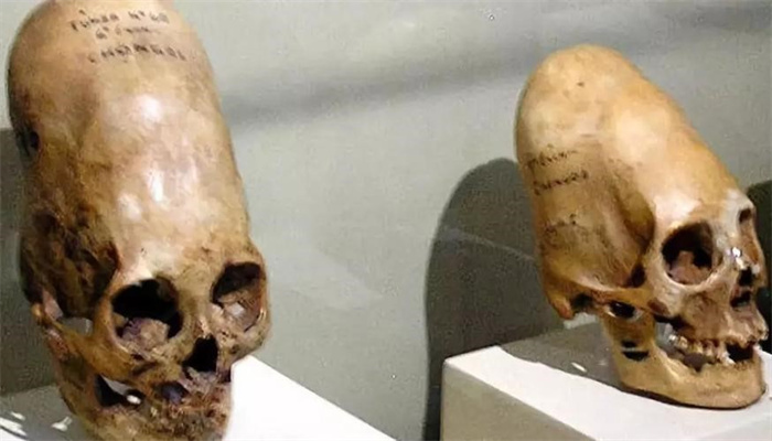 在南极发现圆柱形的头骨 被认为是外星人 DNA检测揭晓身份