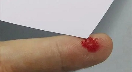 为什么被纸划伤手会特别痛？