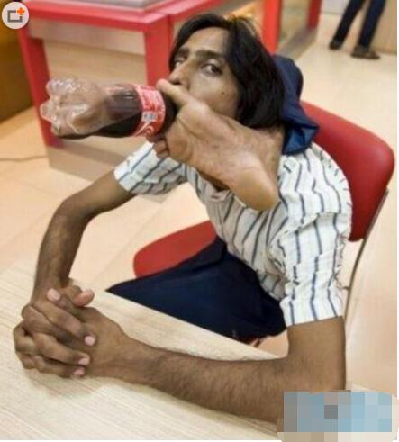 世界五大橡胶人，印度橡胶人伟杰·沙马能用脚喝水