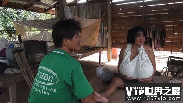 泰国一女子因患怪病导致胸部疯长 重到脖子都被拉伤