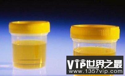 是什么使得尿液呈现黄色