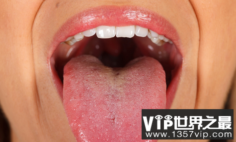 拥有世界上最长的舌头也是令人惊奇的
