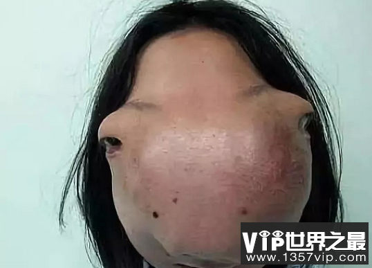 世界上最奇怪的变异人，有点恐怖