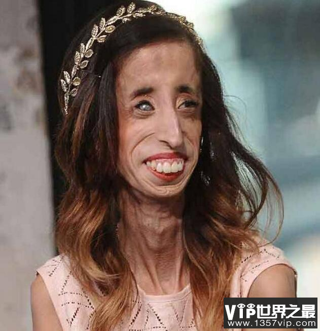 世界上最瘦的女孩，你还要减肥吗？