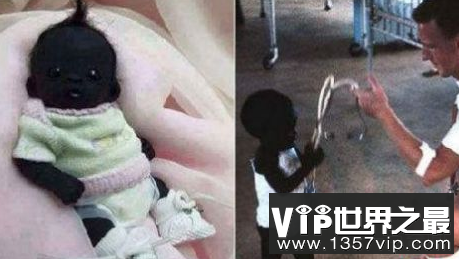 世界上最黑暗的南非婴儿已经走出了一个新的高度