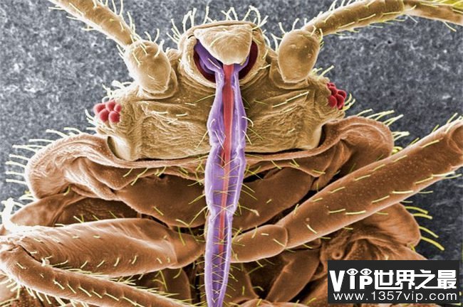 十大最恶心的寄生虫排名 最恶心的寄生虫是什么