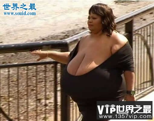 关于女人胸部的10个世界之最，最大的乳房重77斤(www.5300tv.com)