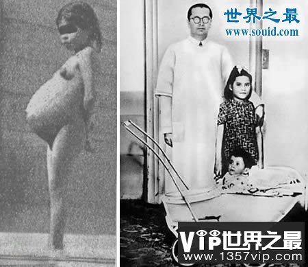 世界上最大的婴儿，出生既37斤(等同于6岁孩子体重)(www.5300tv.com)