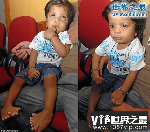 世界上手指脚趾最多的人，印度婴儿14个手指/20脚趾(www.5300tv.com)