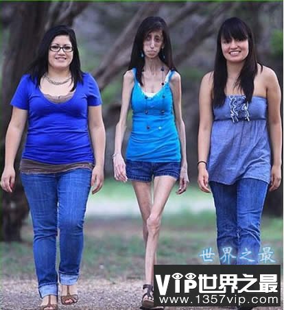 世界上最瘦的女人，像纸人一样(25公斤)(www.5300tv.com)