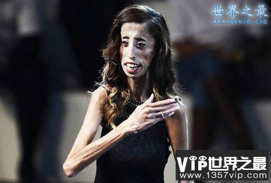 世界上最瘦的女人，像纸人一样(25公斤)(www.5300tv.com)