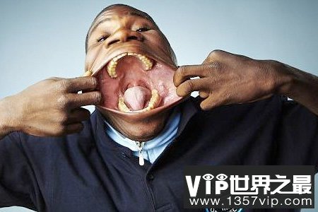 世界上最大的嘴，嘴巴最大的人(宽17厘米)(www.5300tv.com)
