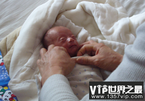 世界上最小的婴儿：阿米利娅·泰勒，体重仅280克
