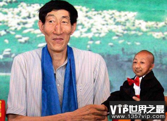 世界上最矮的人,何平平的死因调查