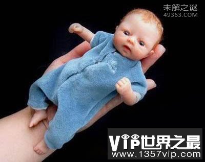世界上最小的婴儿阿米利娅·泰勒:出生仅280克(今年14岁)