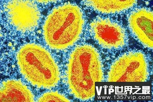 科学实验首次见证艾滋病病毒诞生过程