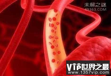 科学家揭秘:人类基因是肢体再生的关键