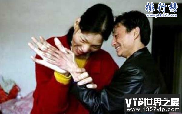 中国最高的女人是谁,姚德芬身高2.4米(脚长45.5厘米)