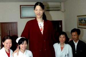 中国最高的女人是谁,姚德芬身高2.4米(脚长45.5厘米)
