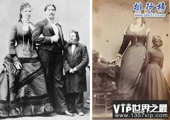关于长度的人体世界之最，盘点人体最长的器官
