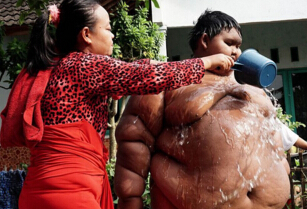 世界上最胖的孩子，印尼十岁男孩体重惊人(192公斤)
