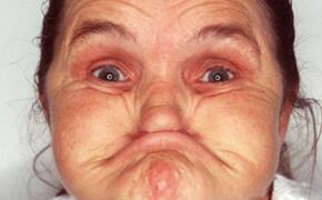 世界上最丑陋的人，62岁的安妮·伍兹(面部表情丑哭你)