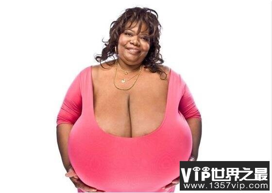 世界上最大的胸部，安妮·霍金斯特纳(胸部重达77斤)