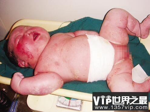 世界上最重的女婴 母亲孩子体重超标