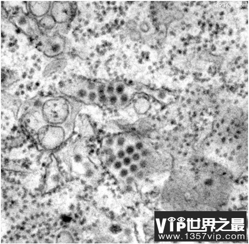 人类历史上12种最致命病毒,冠状病毒上榜