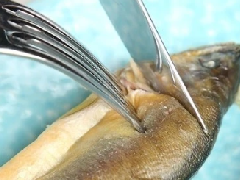 鱼刺卡到喉咙最好办法，很小的鱼刺卡在喉咙会溶解吗