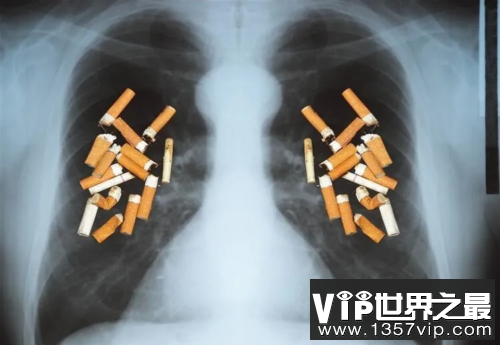 戒烟后肺部能恢复健康吗