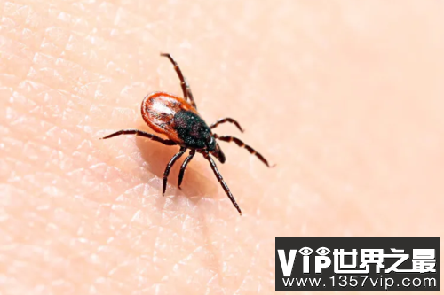 为什么男人突然长阴虱了？需要把毛剃光吗