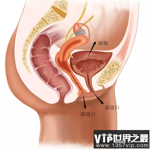 尿道、阴道不是一个口
