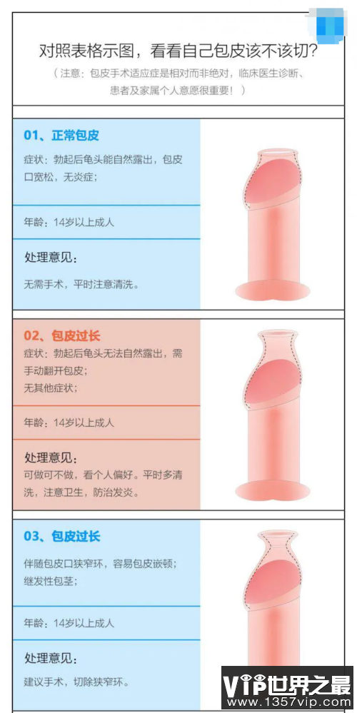 如何判断包皮是否过长