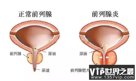 抬不起头