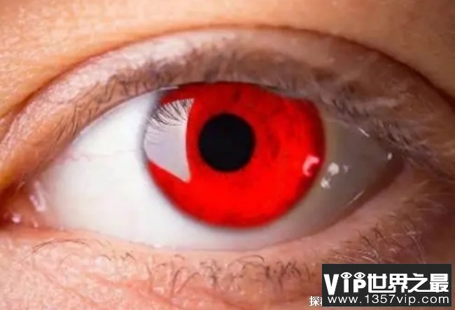 世界上十大稀有的瞳孔色 一黄一蓝双色瞳孔(称为异瞳)