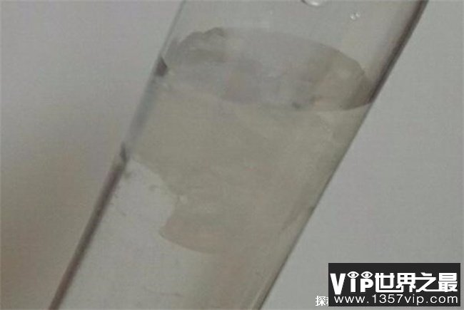 老人输液瓶内现絮状物抢救3小时 成功救活(医院回应)