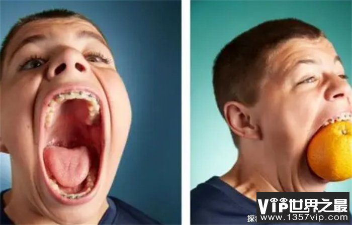 世界上嘴最大的人他的嘴可以张开10厘米(来自于美国)