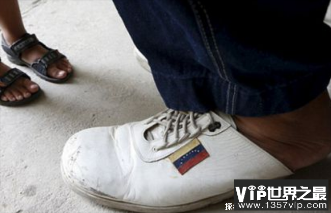 世界上最大的脚 来自委内瑞拉的男子(均40.4厘米)