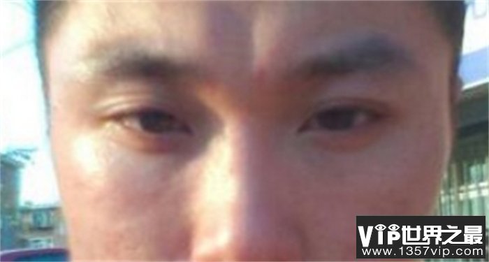 男人印堂凹陷事业发展如何 财运运势怎么样（不好）