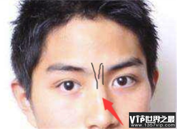 男人印堂凹陷事业发展如何 财运运势怎么样（不好）