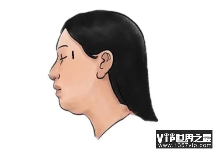 奸门有纵纹