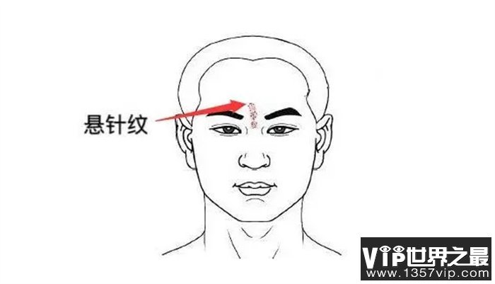 悬针纹