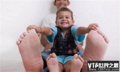 世界上脚掌最大的人 来自委内瑞拉的杰森（最大脚掌）