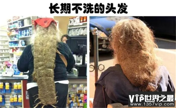 世界上最脏的人：87岁老人60多年不洗澡  全因被一个女人拒绝
