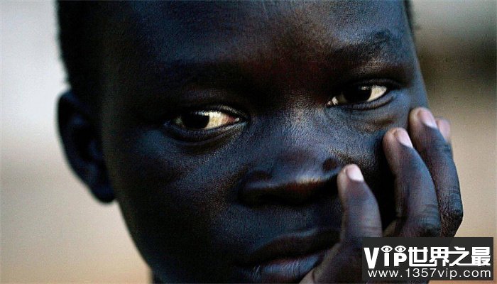 世界上最黑的人 2015年出生的小孩（非洲小孩）