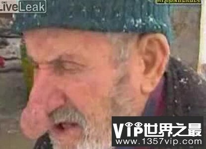 世界上最长的鼻子