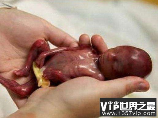 世界上最小的婴儿，还没有一支笔大