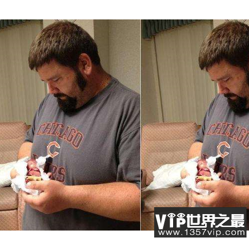 世界上最小的婴儿，体重只有250克和一个鸡蛋一样重。